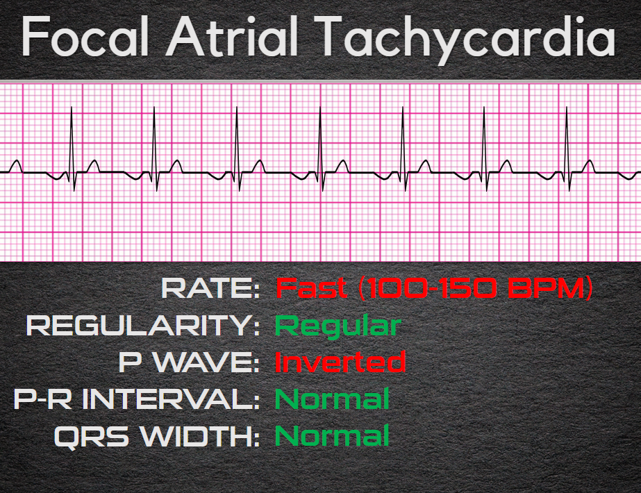 EKG Certification - Level 4