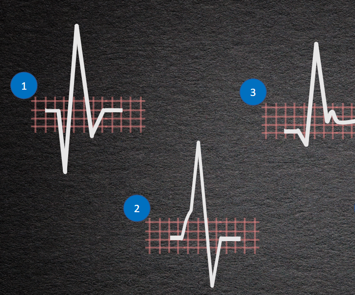 EKG Certification - Level 4